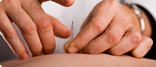 Aberdeen Acupuncture and Chinese Medicine