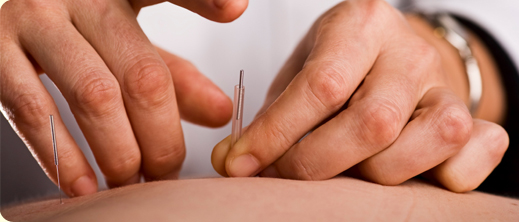 Aberdeen Acupuncture